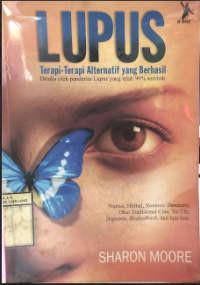Image of LUPUS, Terapi Alternatif Yang Berhasil